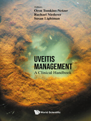 cover image of Uveitis Management